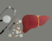 Hepatopatia: čo to je, ako sa prejavuje a čo pomáha pečeni